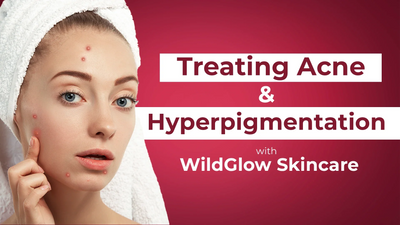 3 Different Types of Face Serum for Glowing Skin, Brightening Skin, Hyperpigmentation, Acne!