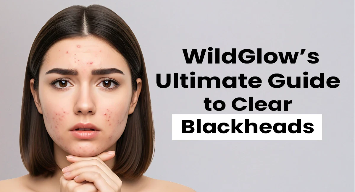Manage Blackheads