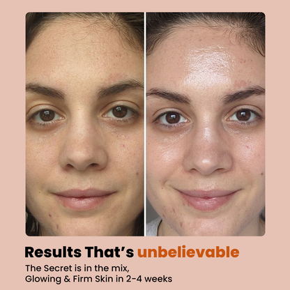 Rose Quartz Roller & Gua Sha Set + 24K Serum for Glow & Lift