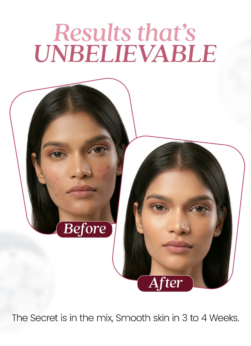 Before and after comparison of a woman's face with text 'Results that's UNBELIEVABLE' and 'The Secret is in the mix, Smooth skin in 3 to 4 Weeks.'.