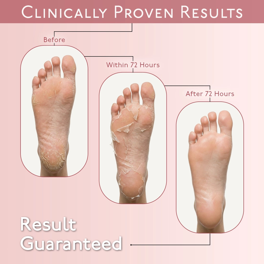 Korean Foot Mask with Cherry Blossom