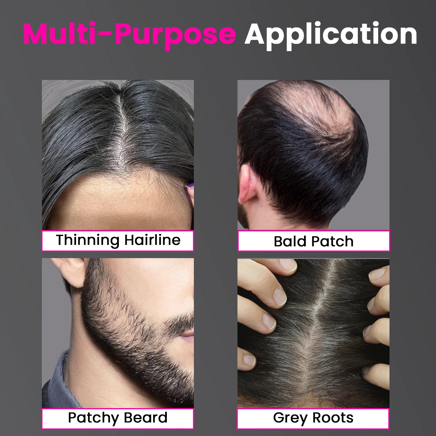 Advanced Hairline Density Filler Powder – Covers Grey Roots & Bald Spots Instantly (10gm)