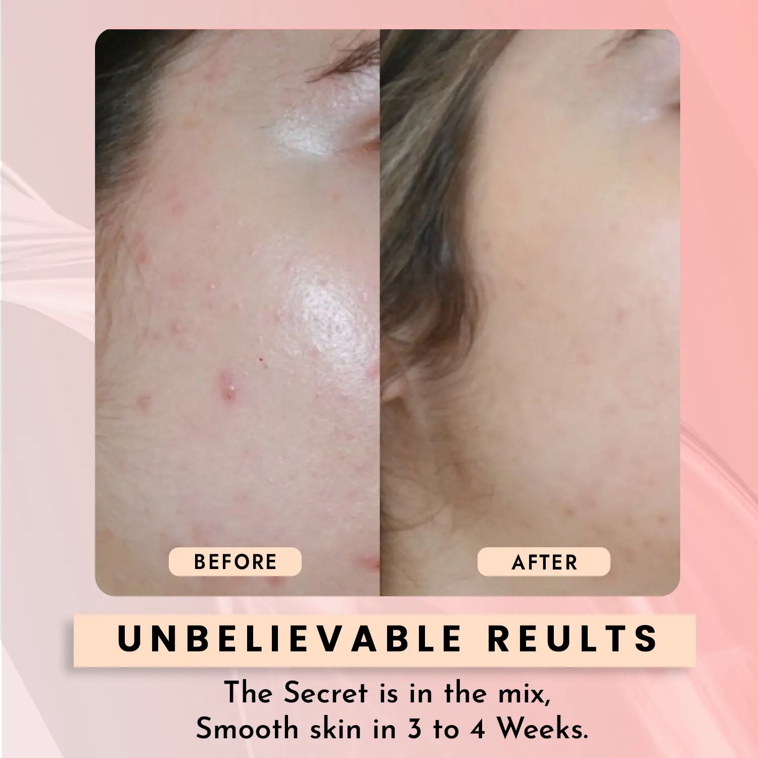 10% Niacinamide Face Serum | Pore-Minimizing & Texture-Refining Serum for Clear, Glowing Skin 30ml