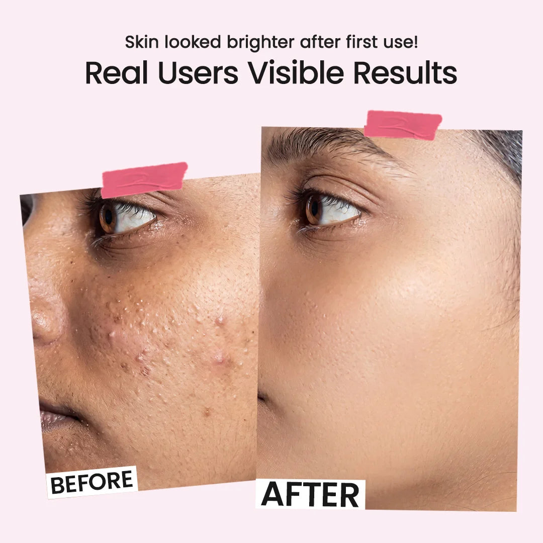 Red Wine Gel Face Mask | 50GM