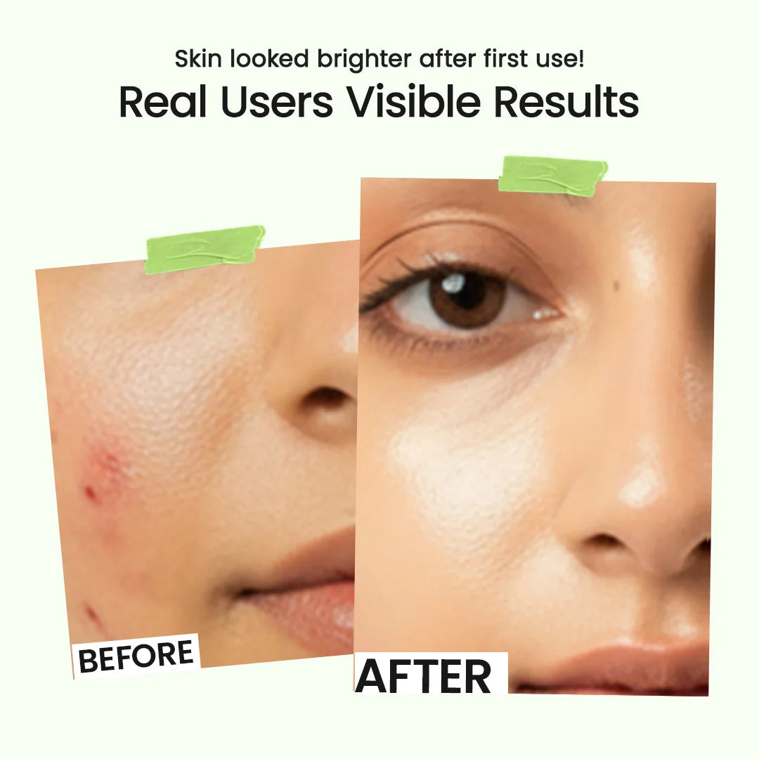 2% Salicylic Acid Face Serum | 30ml