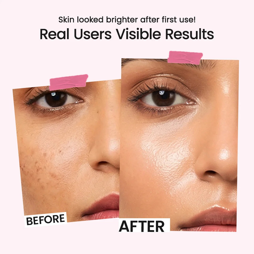 10% Niacinamide Face Serum | 30ml