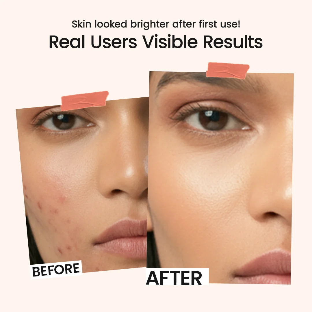 2% Kojic Acid Face Serum | 30ml