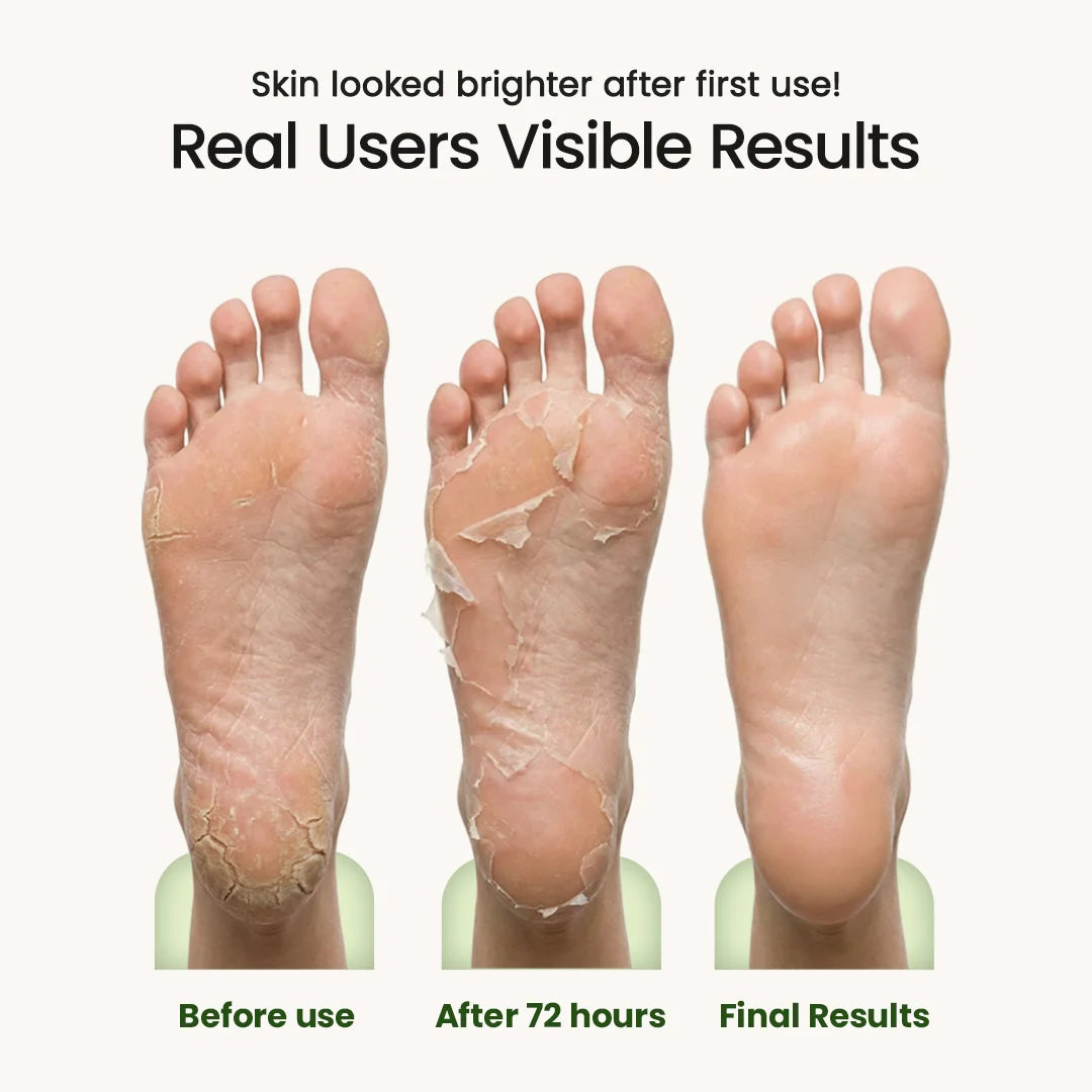 Korean Foot Mask with Avocado & Shea Butter