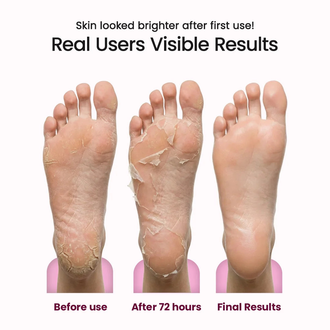 Korean Foot Mask with Cherry Blossom