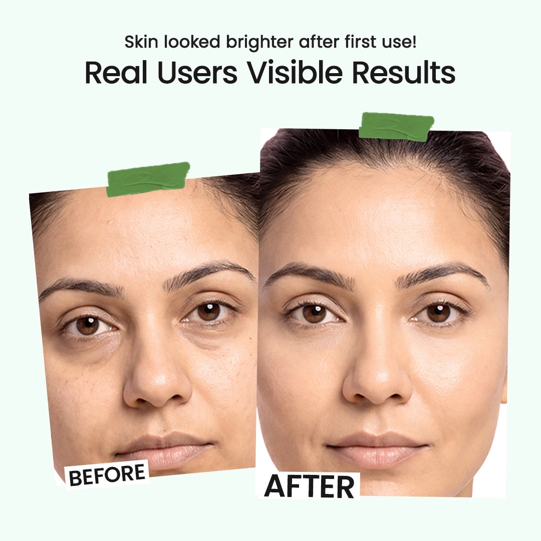 Before and after comparison of a woman's face showing brighter, smoother skin after use, with text reading 'Skin looked brighter after first use! Real Users Visible Results' on a pale mint background.