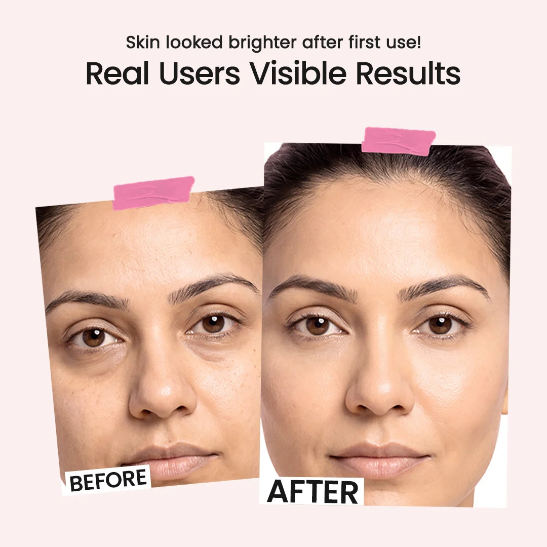 Before-and-after comparison of a woman's face showing brighter, smoother skin after use, with text reading 'Skin looked brighter after first use! Real Users Visible Results' on a pale pink background.