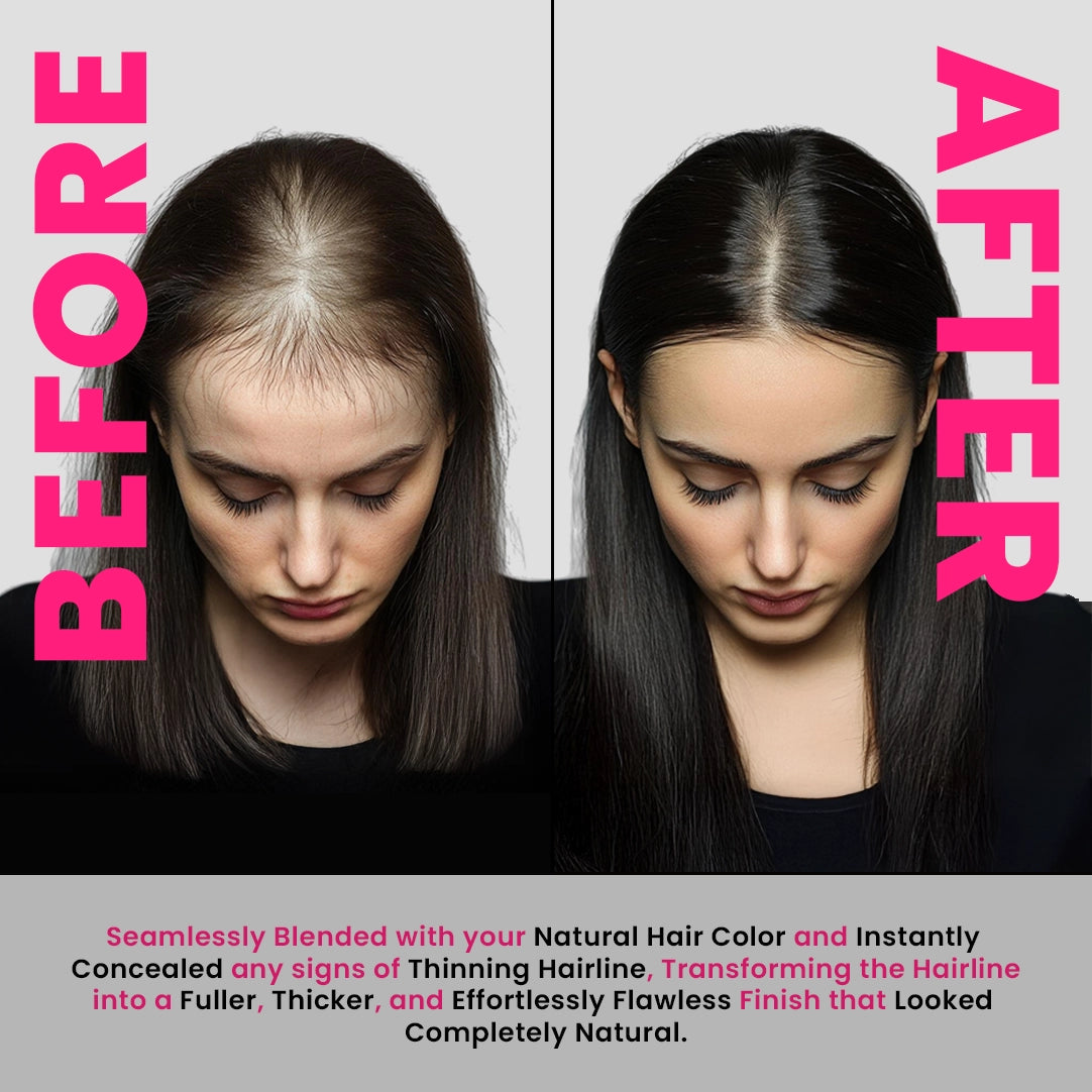 Advanced Hairline Density Filler Powder – Covers Grey Roots & Bald Spots Instantly (10gm)