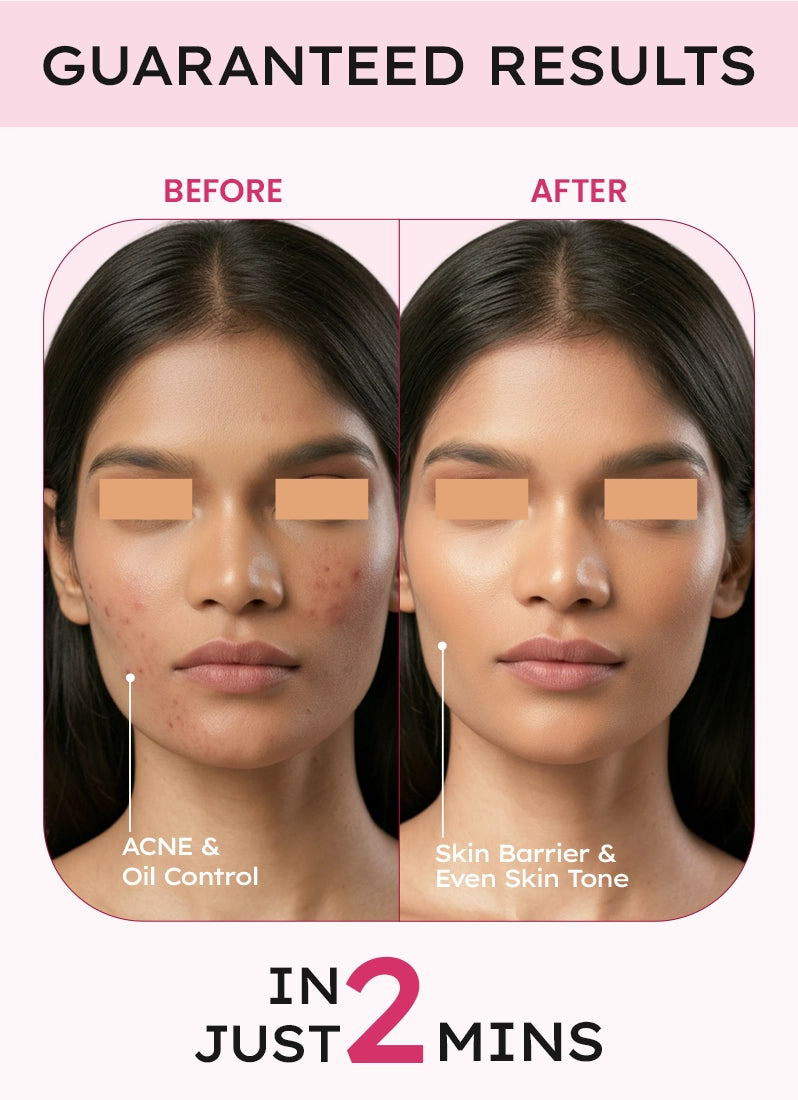 Before and after comparison of skin with acne and oil control on the left, and skin barrier and even skin tone on the right, with text indicating guaranteed results in 2 minutes.