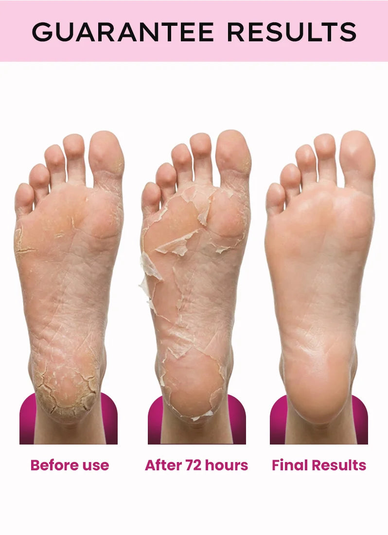 Before and after foot treatment results with a pink background and text.