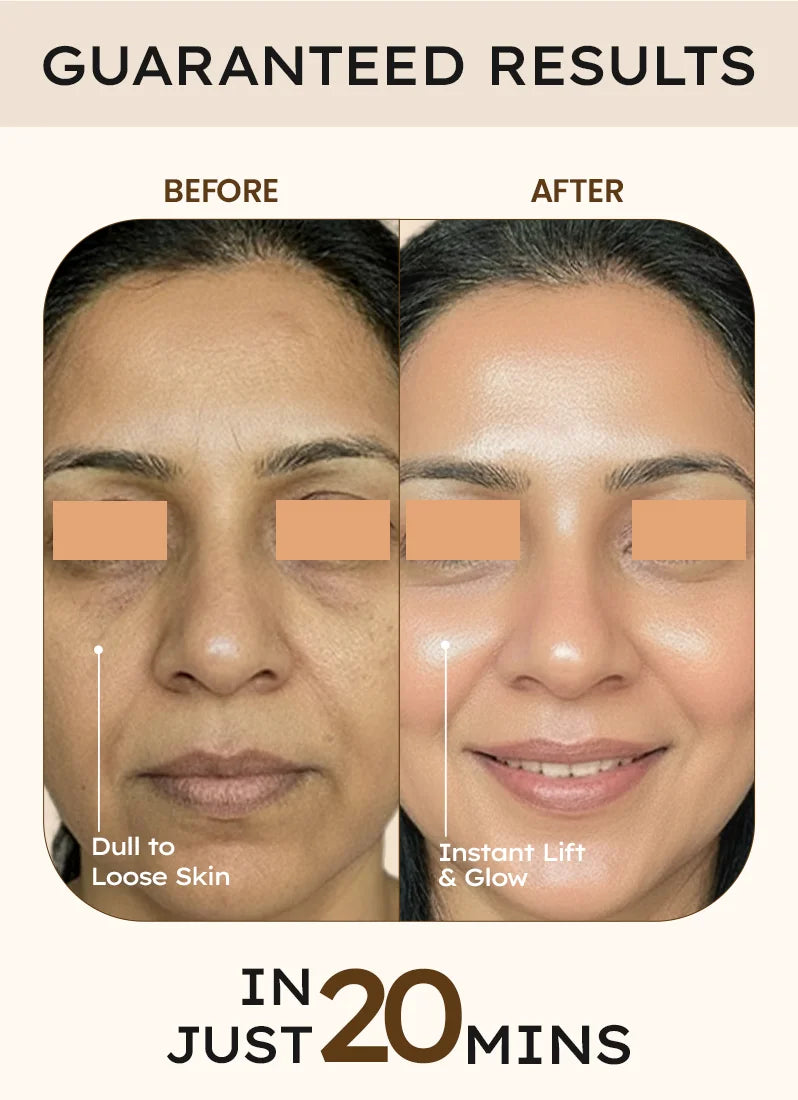 Before and after comparison of facial treatment with guaranteed results in 20 minutes.