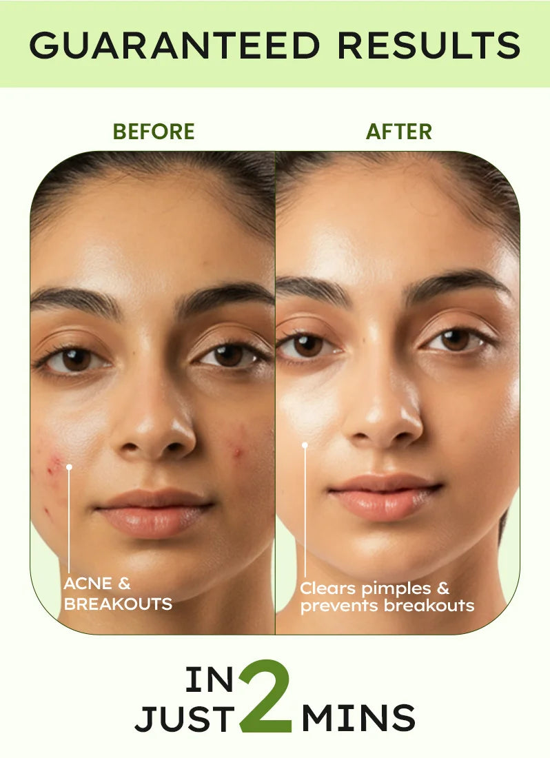 Before and after comparison of a person's face with acne and breakouts, showing clear skin in 2 minutes.