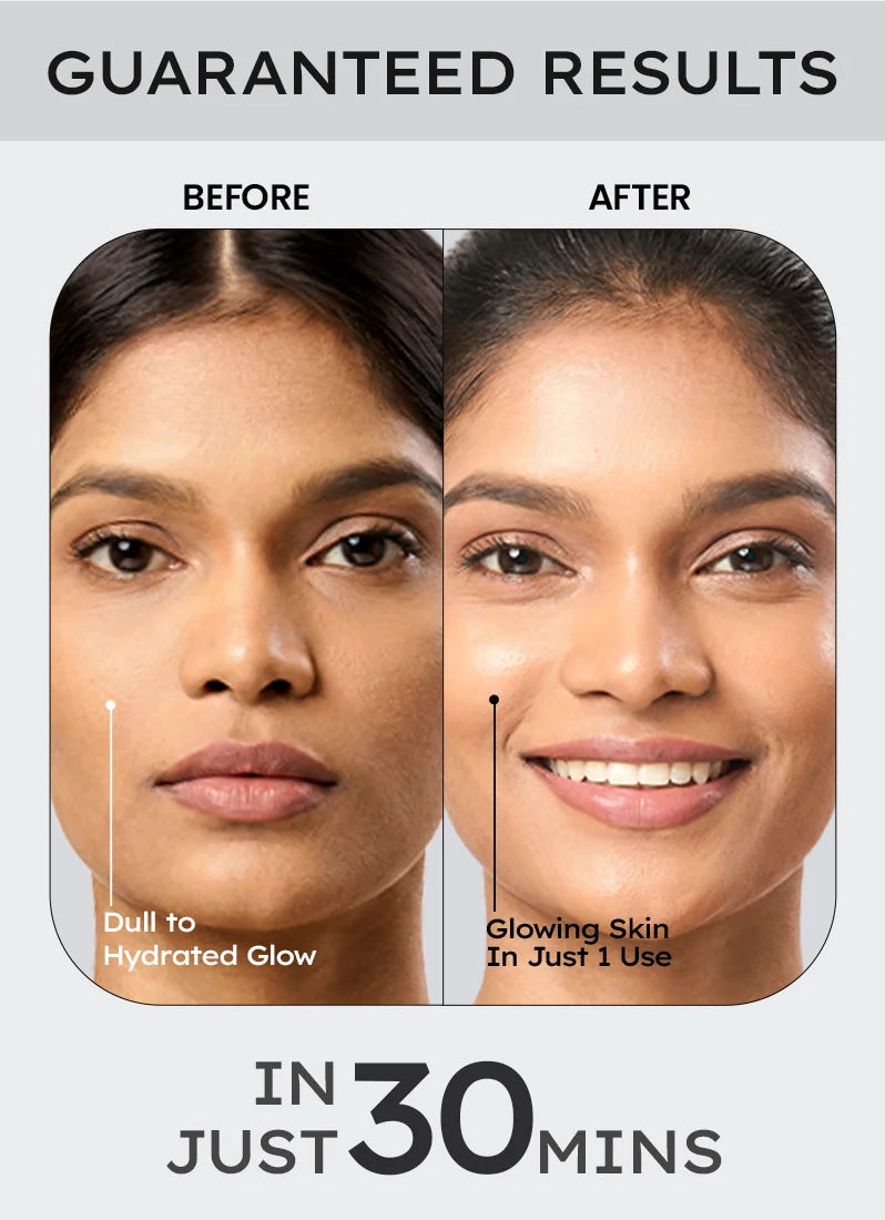 Before and after comparison of a woman's face with text indicating 'Guaranteed Results' and 'In Just 30 Mins'.