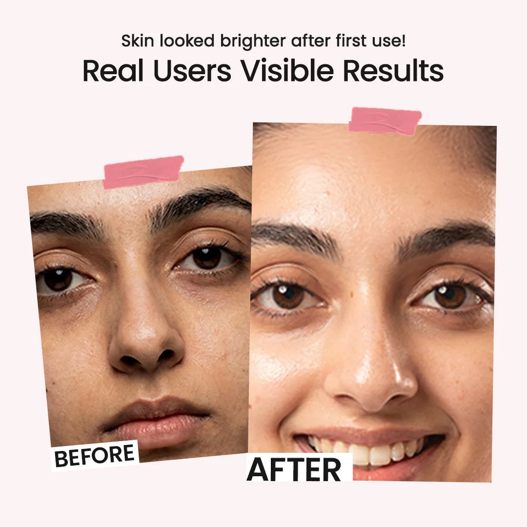 Before-and-after facial skin comparison showing a woman's face with text reading 'Skin looked brighter after first use! Real Users Visible Results' on a light pink background.