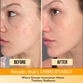 Load image into Gallery viewer, Kojic Acid & Turmeric Korean Cleansing Pads -40Pcs
