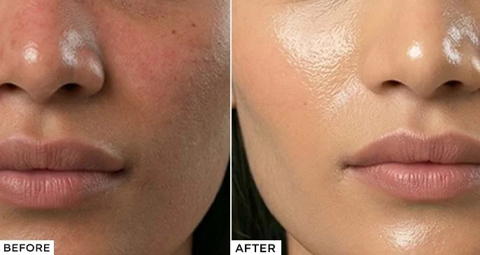 Before and after comparison of a person's face with skincare product application.