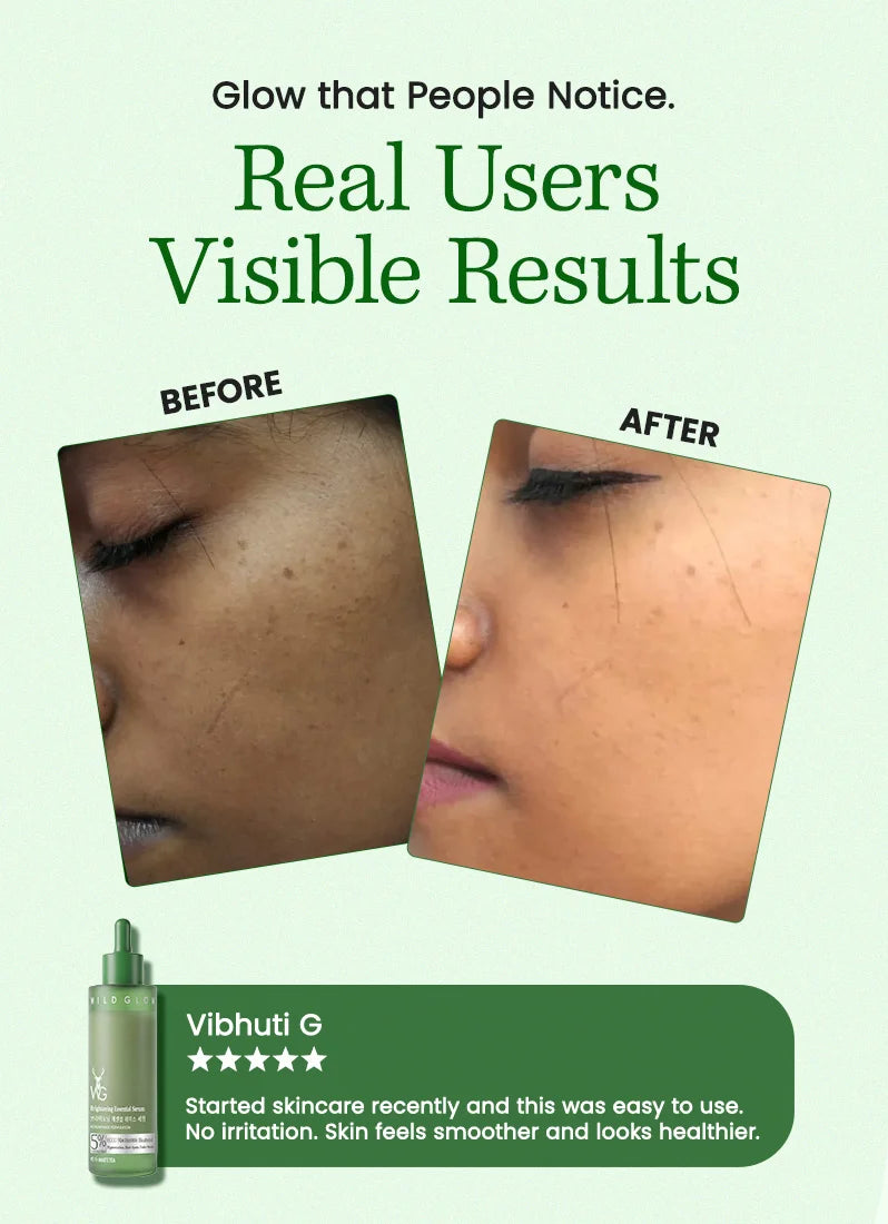 Before and after skin comparison with a green bottle labeled 'Vibhuti G' on a light green background.