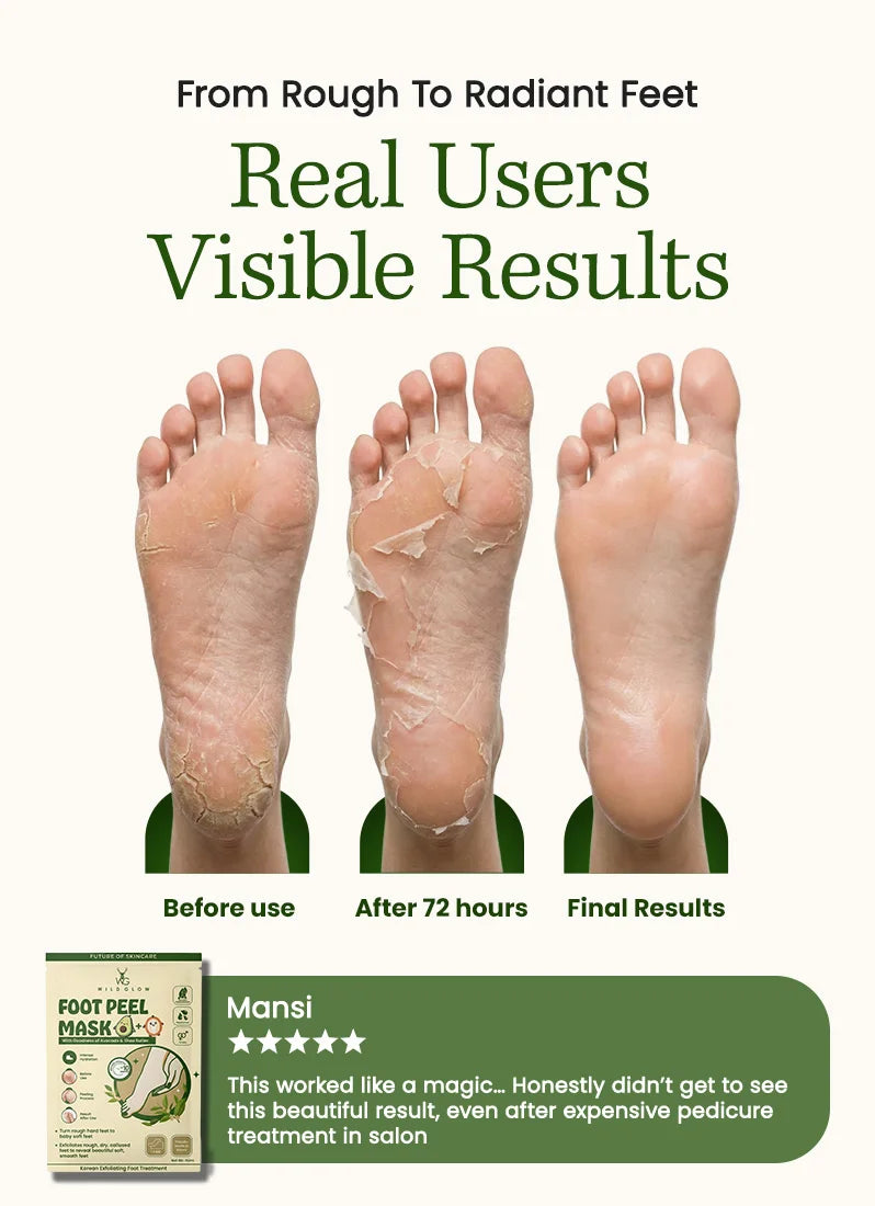 Before and after effects of a foot peel mask with visible results on feet.