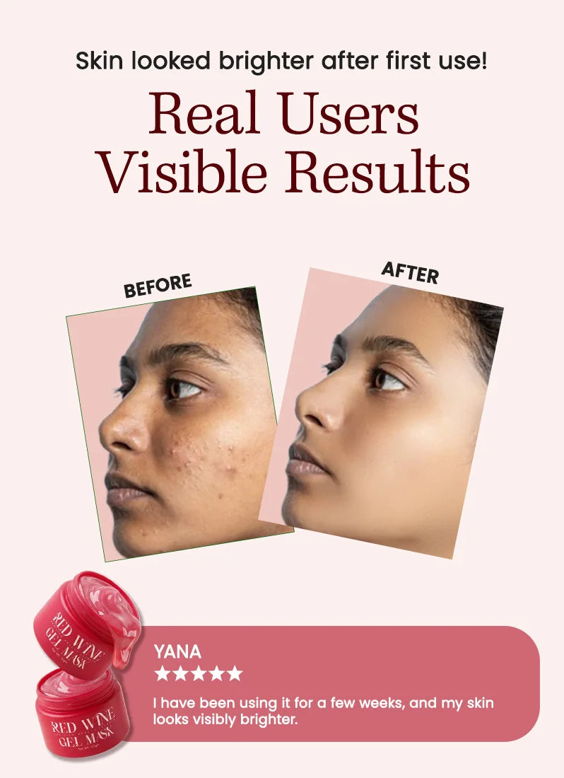 Before and after skin comparison with product packaging and user review on a white background