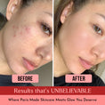 Load image into Gallery viewer, Red Wine Gel Face Mask With Paris-Based Red Wine Extracts (50 GM)
