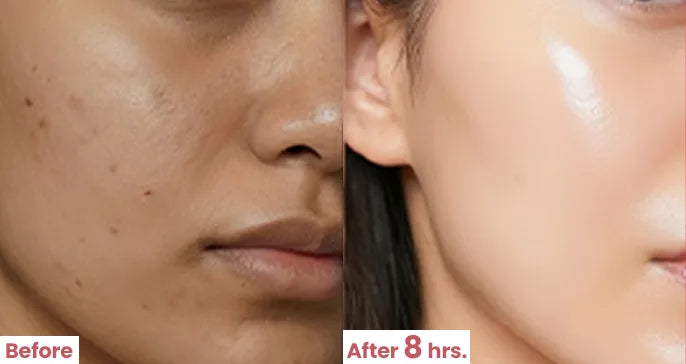 Before and after comparison of a person's face with visible skin improvement after 8 hours.